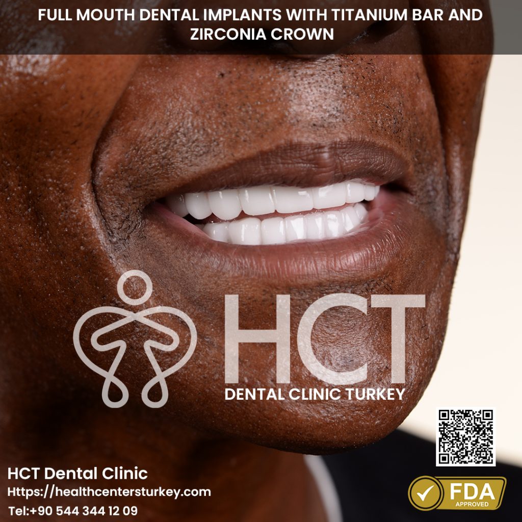 Before - After Gallery 4 All-on-6 Dental Implant with Titanium Bar Turkey Before and After