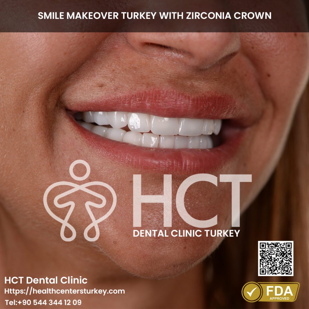 Before - After Gallery 1 Missing Teeth Restoration Turkey Before and After