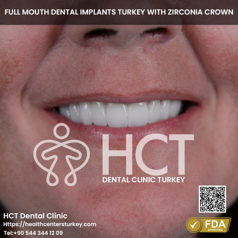 Full Set Dental Implant Turkey Before and After