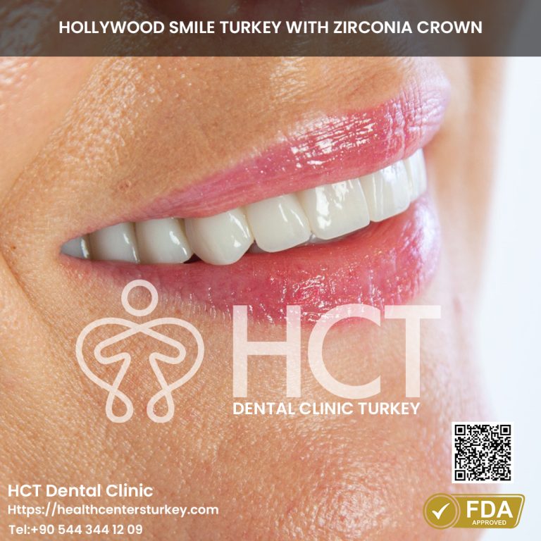 Zirconium Crowns Turkey Before and After